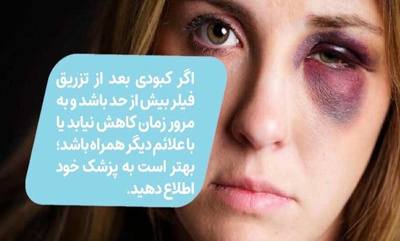 آیا فیلر زیر چشم باعث کوچک شدن چشم میشود؟