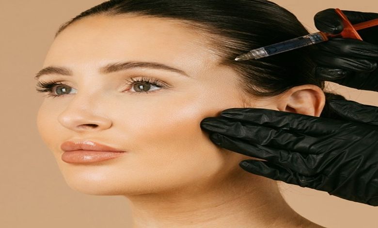 فیلر شقیقه