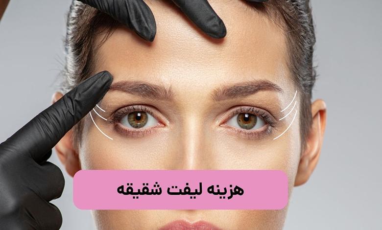هزینه فیلر شقیقه